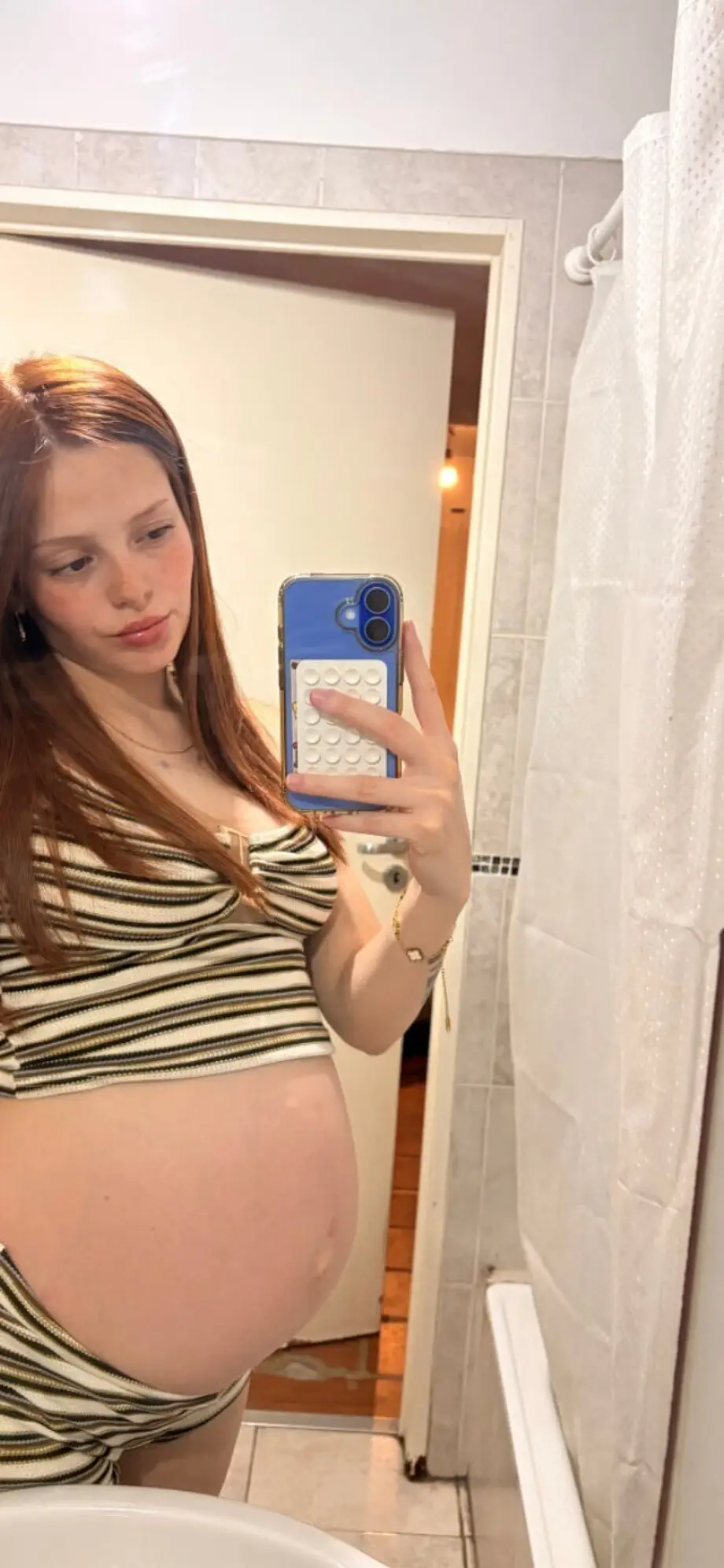 MIA 18 Freshly pregnant π